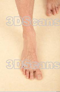 Photo reference of foot 0005